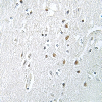 19 - Anti-SSBP2 Antibody AP51680