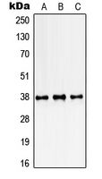 1 - Anti-SSBP2 Antibody AP51680