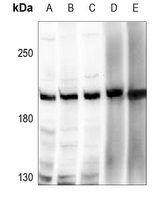 1 - Anti-ZNF638 Antibody AP51685