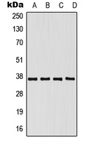 1 - Anti-hnRNP E1 Antibody AP51686