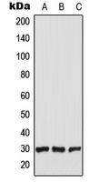 1 - Anti-CT47 Antibody AP51687