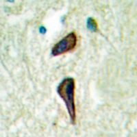 19 - Anti-Cytochrome P450 2E1 Antibody AP51692