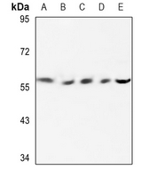 1 - Anti-Cytochrome P450 2E1 Antibody AP51692