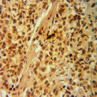 19 - Anti-G18 Antibody AP51693