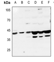1 - Anti-5-HT1D Antibody AP51694