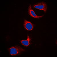 3 - Anti-IFITM3 Antibody AP51695