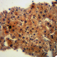 19 - Anti-IFITM3 Antibody AP51695