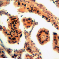 19 - Anti-RAIDD Antibody AP51696