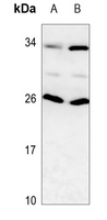 1 - Anti-RAIDD Antibody AP51696