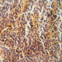19 - Anti-Galectin 1 Antibody [KO/KD Validated] AP51698