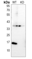0 - Anti-Galectin 1 Antibody [KO/KD Validated] AP51698