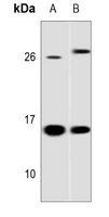 1 - Anti-Galectin 1 Antibody [KO/KD Validated] AP51698