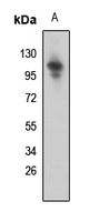 1 - Anti-SNRP116 Antibody AP51701
