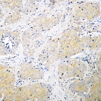 19 - Anti-PSMD3 Antibody AP51702