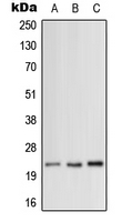 1 - Anti-MRPL12 Antibody AP51703