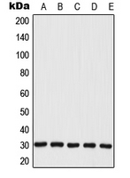 1 - Anti-MRPL28 Antibody AP51704