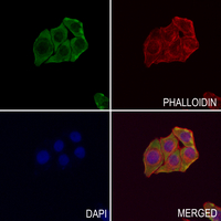 3 - Anti-RPS18 Antibody AP51705