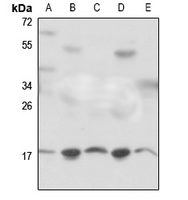 1 - Anti-RPS18 Antibody AP51705