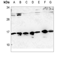1 - Anti-RPS19 Antibody AP51706