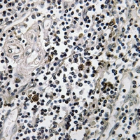 19 - Anti-RPS3 Antibody AP51707