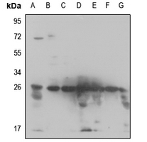 1 - Anti-RPS3 Antibody AP51707