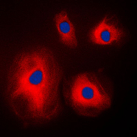 3 - Anti-RPS4X Antibody AP51708
