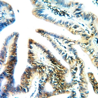 19 - Anti-RPS4X Antibody AP51708