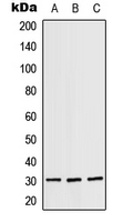 1 - Anti-RPS4X Antibody AP51708
