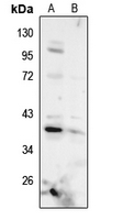 1 - Anti-AMPK gamma 1 Antibody AP51709