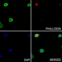3 - Anti-TROVE2 Antibody AP51710
