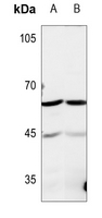 1 - Anti-TROVE2 Antibody AP51710