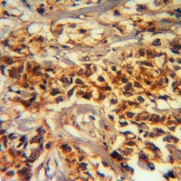 19 - Anti-ADAMTS2 Antibody AP51715