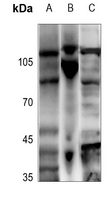 1 - Anti-ADAMTS2 Antibody AP51715
