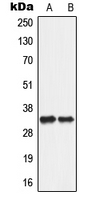 1 - Anti-ANT2 Antibody AP51716