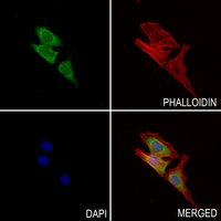 3 - Anti-AKR1A1 Antibody AP51718