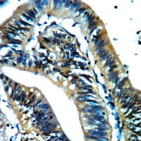 19 - Anti-AKR1A1 Antibody AP51718