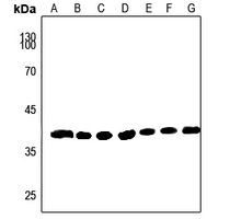 1 - Anti-AKR1A1 Antibody AP51718