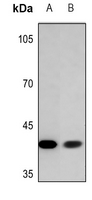 1 - Anti-ADH7 Antibody AP51719