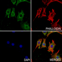 3 - Anti-ALDH3B2 Antibody AP51720