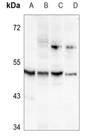 1 - Anti-ALDH3B2 Antibody AP51720