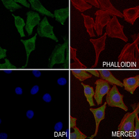 3 - Anti-Aldehyde Oxidase Antibody AP51721
