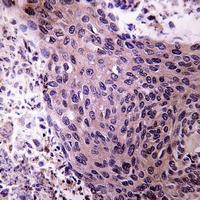 19 - Anti-Aldehyde Oxidase Antibody AP51721