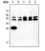 1 - Anti-Orosomucoid 2 Antibody AP51722