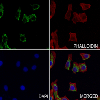 3 - Anti-AAMP Antibody AP51723