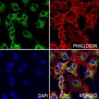 3 - Anti-ATP6 Antibody AP51728