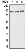 1 - Anti-ABCC11 Antibody AP51732