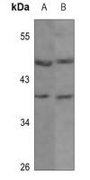 1 - Anti-Kir4.1 Antibody AP51735