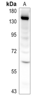 1 - Anti-CHERP Antibody AP51737