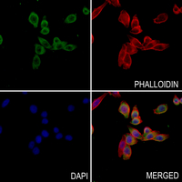 3 - Anti-CABP4 Antibody AP51738