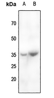 1 - Anti-CABP4 Antibody AP51738